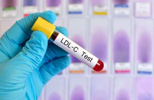 LDLコレステロールテスト